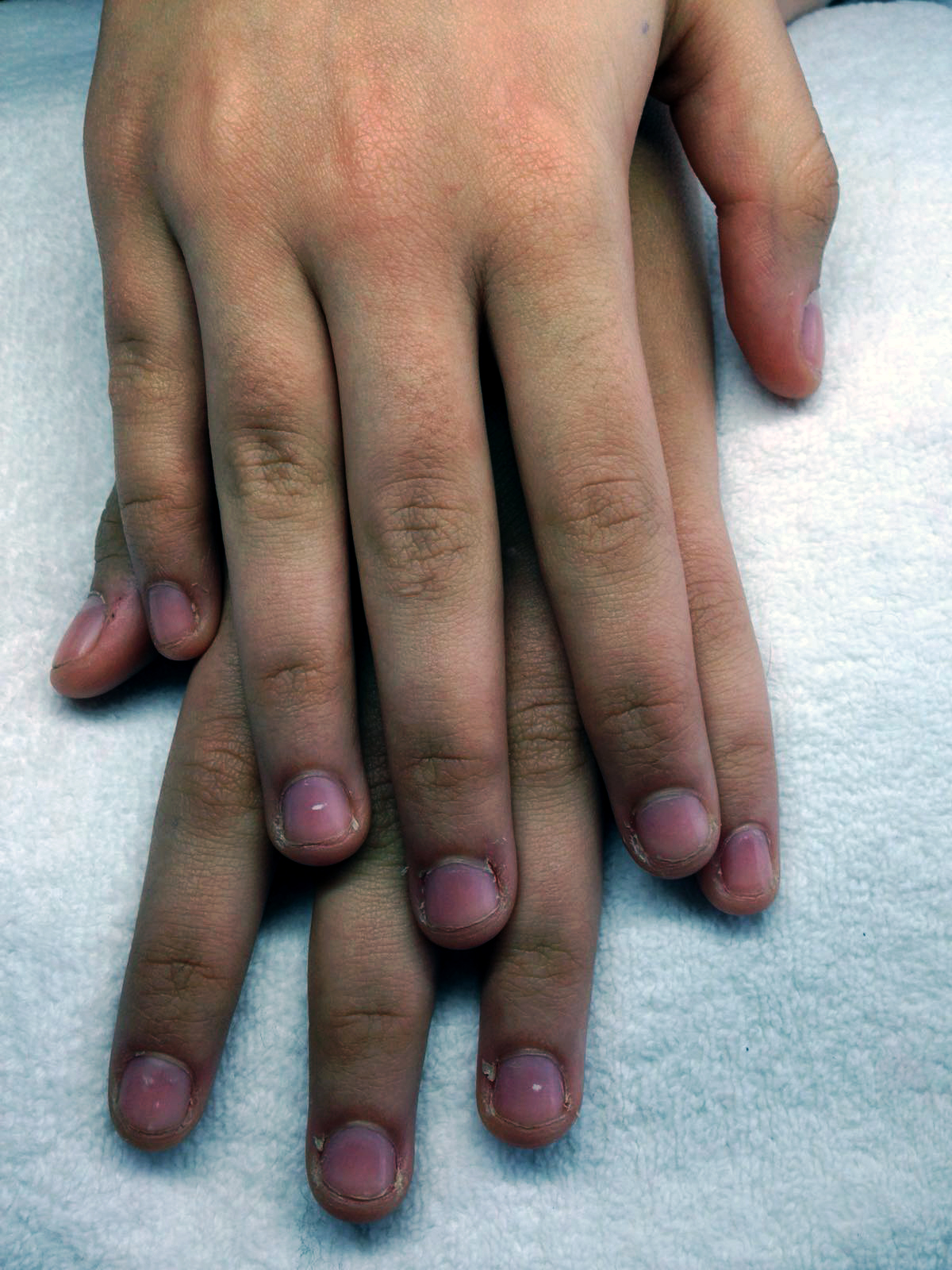 Avant : ongles naturels