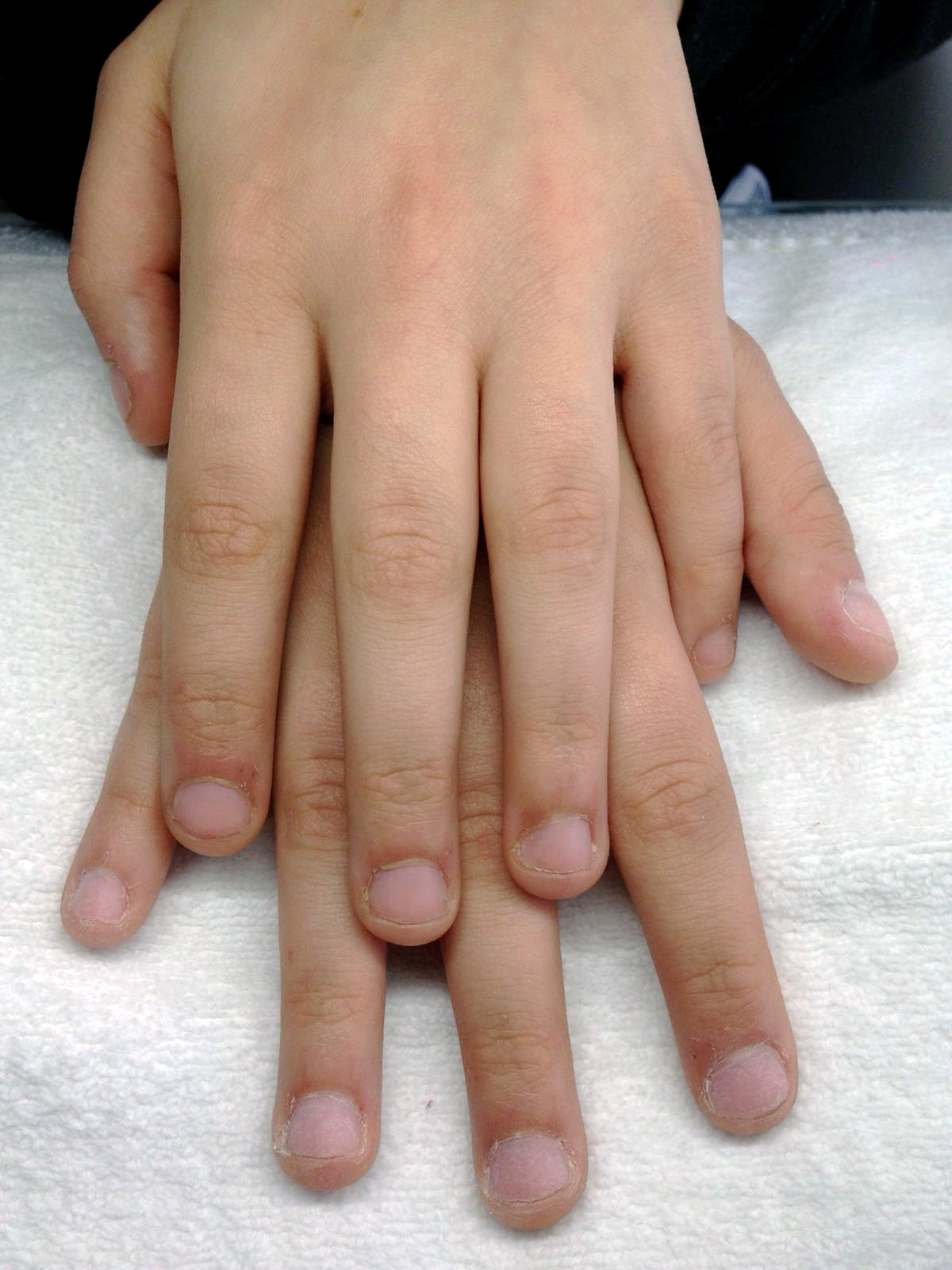 Avant : ongles naturels