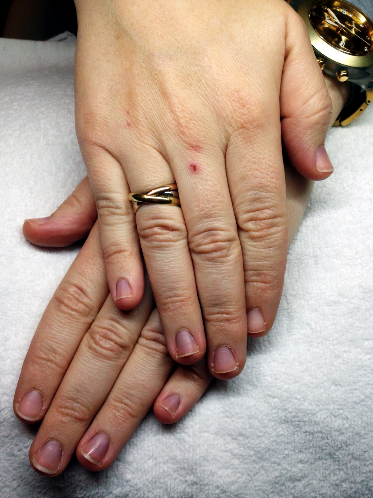 Avant : ongles naturels