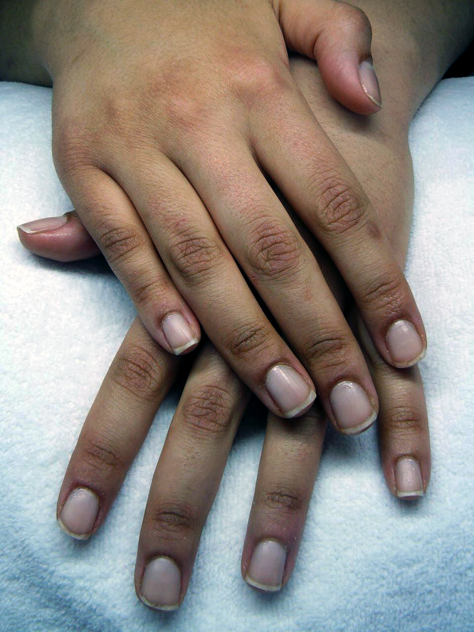 Avant : ongles naturels