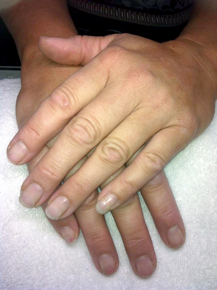 Avant : ongles naturels