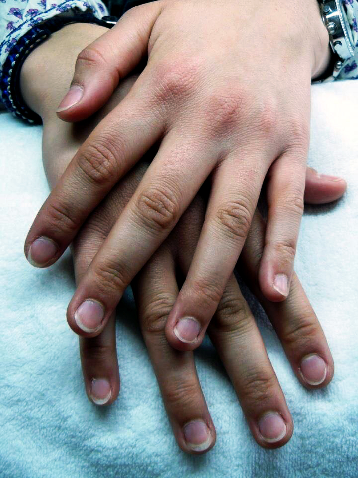 Avant : ongles naturels